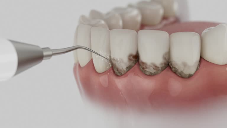 Trusted Tooth Extraction service in Parkville, PA - Dentist Open Now